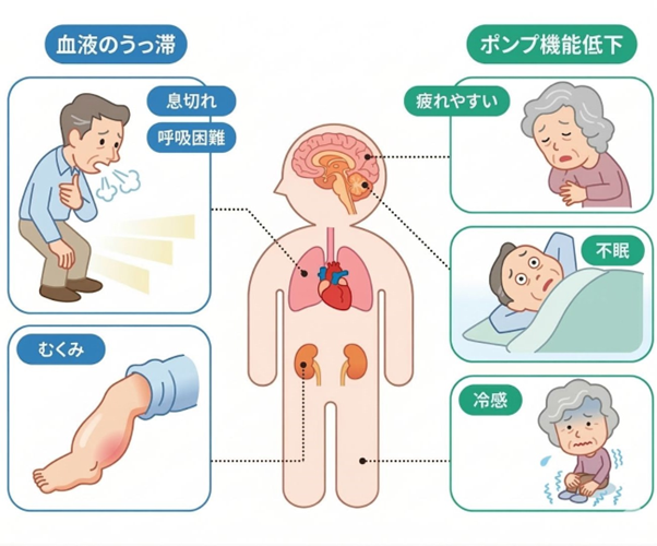 心不全の症状イラスト