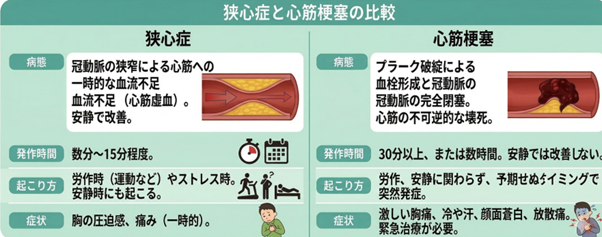 狭心症と心筋梗塞の比較